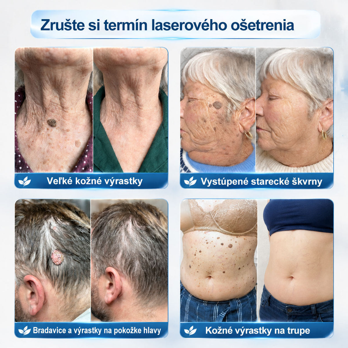 𝐎𝐟𝐢𝐜𝐢á𝐥𝐧𝐚 𝐩𝐫𝐞𝐝𝐚𝐣ň𝐚 𝐳𝐧𝐚č𝐤𝐲 𝐏𝐢𝐜𝐝𝐨® 💚💚𝟕-𝐝ň𝐨𝐯ý 𝐨𝐝𝐬𝐭𝐫𝐚ň𝐨𝐯𝐚č   𝐤𝐨ž𝐧ý𝐜𝐡 𝐯ý𝐫𝐚𝐬𝐭𝐤𝐨𝐯 𝐚 š𝐤𝐯𝐫𝐧(𝐑𝐨𝐥𝐥𝐞𝐫𝐛𝐚𝐥𝐥 𝐛𝐞𝐳 𝐛𝐨𝐥𝐞𝐬𝐭𝐢, 𝐛𝐞𝐳 𝐣𝐚𝐳𝐢𝐞𝐯)