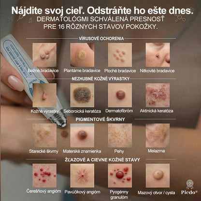 𝐎𝐟𝐢𝐜𝐢á𝐥𝐧𝐚 𝐩𝐫𝐞𝐝𝐚𝐣ň𝐚 𝐳𝐧𝐚č𝐤𝐲 𝐏𝐢𝐜𝐝𝐨® 💚💚𝟕-𝐝ň𝐨𝐯ý 𝐨𝐝𝐬𝐭𝐫𝐚ň𝐨𝐯𝐚č   𝐤𝐨ž𝐧ý𝐜𝐡 𝐯ý𝐫𝐚𝐬𝐭𝐤𝐨𝐯 𝐚 š𝐤𝐯𝐫𝐧(𝐑𝐨𝐥𝐥𝐞𝐫𝐛𝐚𝐥𝐥 𝐛𝐞𝐳 𝐛𝐨𝐥𝐞𝐬𝐭𝐢, 𝐛𝐞𝐳 𝐣𝐚𝐳𝐢𝐞𝐯)